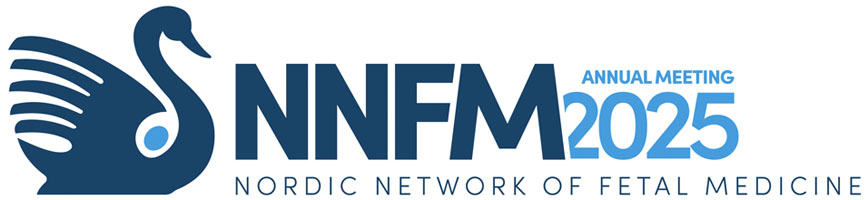 NNFM
